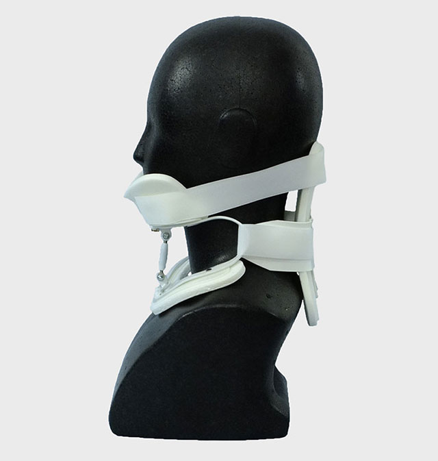 サービカルフレームカラー