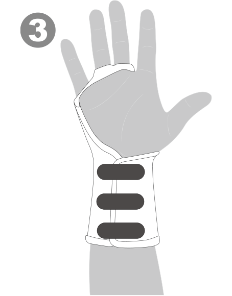 テコウリスト（手甲リスト）