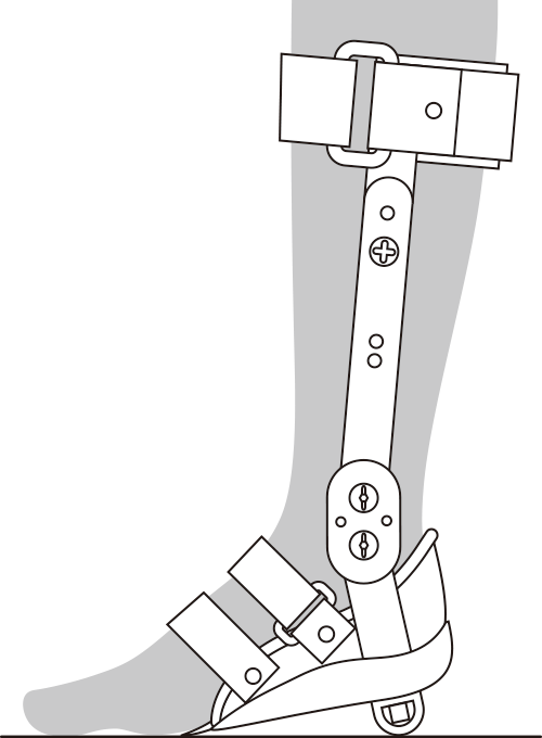 内山式アキレス腱装具 足継手の角度調整方法①