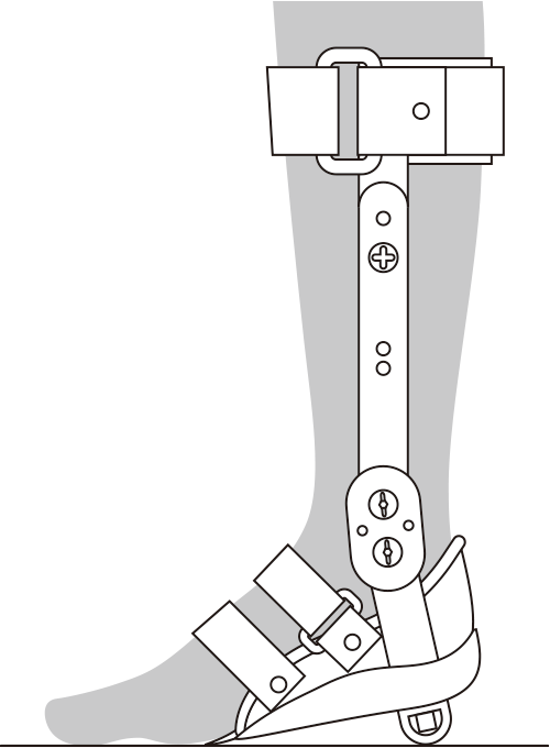 内山式アキレス腱装具 足継手の角度調整方法②