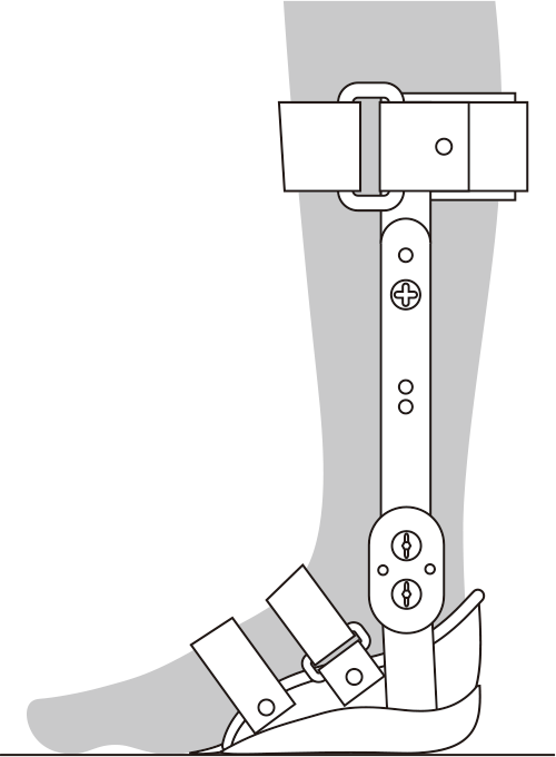 内山式アキレス腱装具 足継手の角度調整方法③