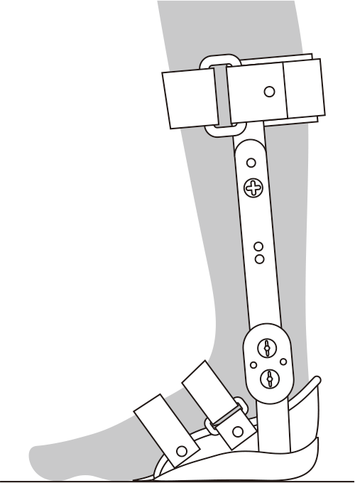 内山式アキレス腱装具 足継手の角度調整方法④